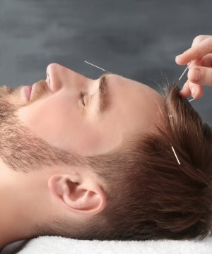 Acupuncture Near Me in Portland, OR